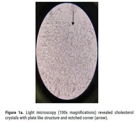 Arthritis Magnifications