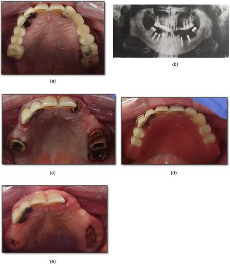 Iconographies Of The Clinical Case A Intraoral Photography In