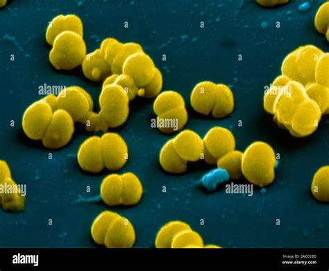 Neisseria Meningitidis Bakterien Farbige Scanning Electron Micrograph