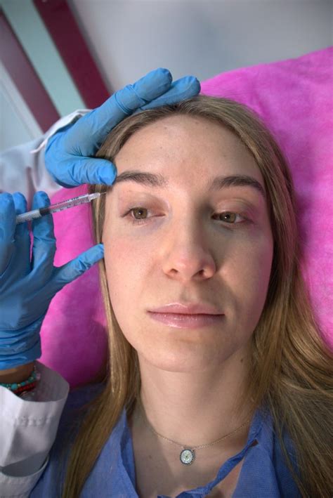 Qué es la toxina botulínica o Botox Rejuvenecimiento Facial