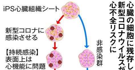 新型コロナ「持続感染」で心不全リスク拡大の恐れ Ips細胞で実験 理研グループ 産経ニュース