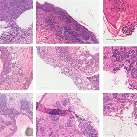 Histologic image samples of BCC | Download Scientific Diagram