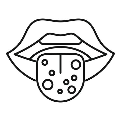 Human mouth showing white tongue with oral thrush candida infection