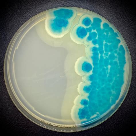 Chromatic Bacillus Cereus Ewc Diagnostics