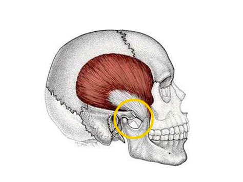 Abordagem Da Fisioterapia Nas Disfun Es Temporomandibulares Dtms