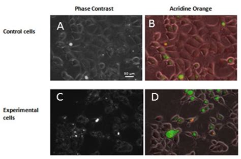 Figure 1 From Triptolide Induces Cytosolic Translocation Of Lysosomal