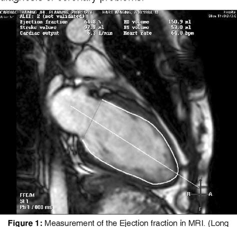 Figure 1 From The Role Of Mri In Diagnosis Of Cardiac Pathologies Semantic Scholar