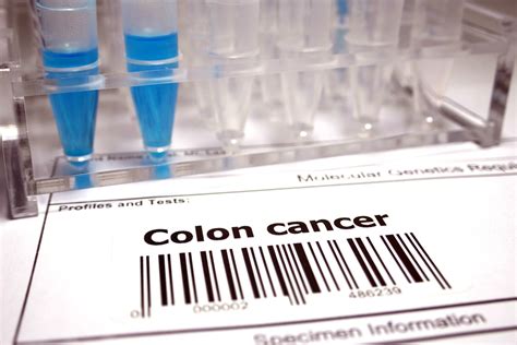 Study: Colon cancer screenings are more effective than previously understood | MIT News ...