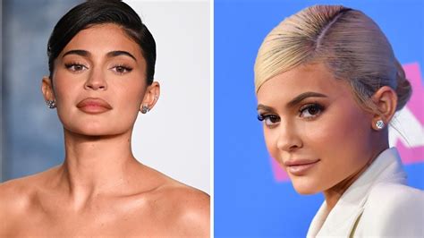 Kylie Jenner Akanusha Kufanya Surgery Kwenye Eneo La Uso Wake Wote