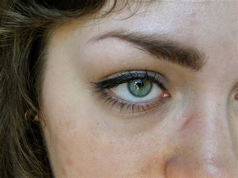 Watery Eyes - Symptoms And Causes - Times News UK