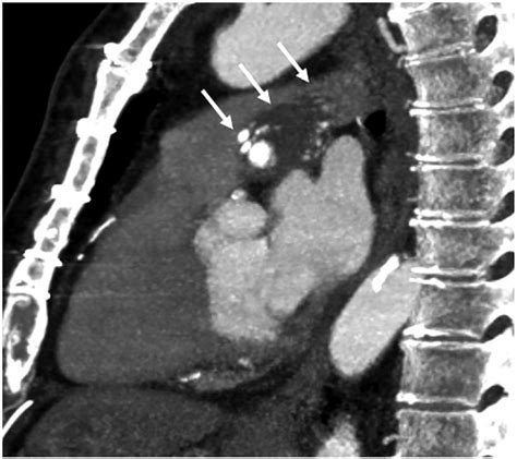 Contrast Enhanced Chest Computed Tomography Scan Download Scientific