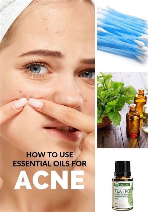 Top Best Essential Oils For Acne Pimples Blackheads Blemishes