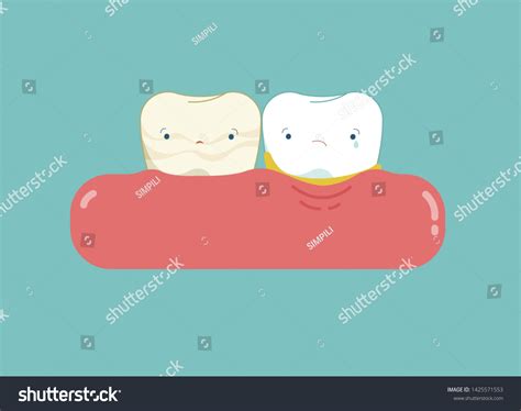 Calculus Teeth Cartoon Dental Concept Stock Illustration 1425571553 ...