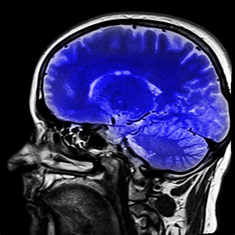 Hd Wallpaper Ct Scan Of Human Brain Head Magnetic Resonance Imaging