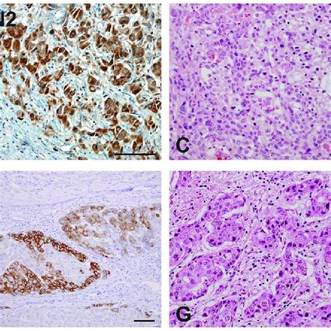 Connective Tissue Growth Factor Ccn Epithelial Membrane Antigen