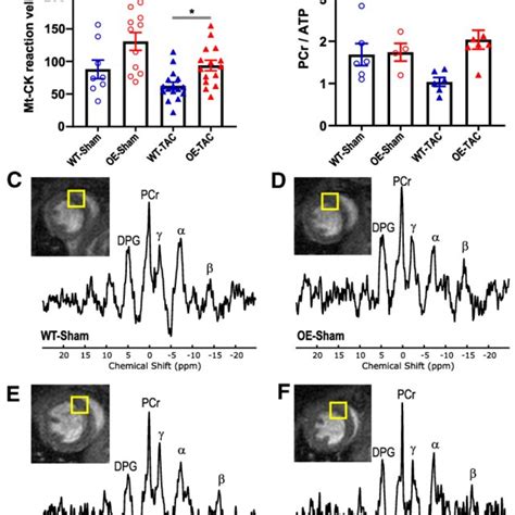 Survival And Echocardiographic Parameters In Sham And Transverse Aortic