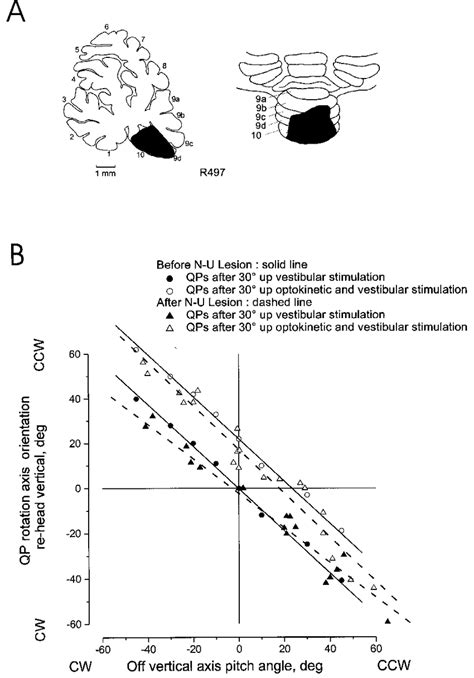 Effect Of Lesions Of The Nodulus And Ventral Uvula On Spatial