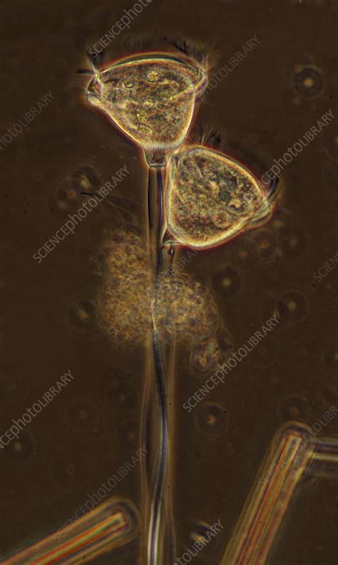 Vorticella Sp Ciliate Light Micrograph Stock Image C056 6044