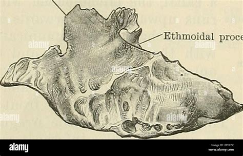 Ethmoid Lamina Papyracea On The Site