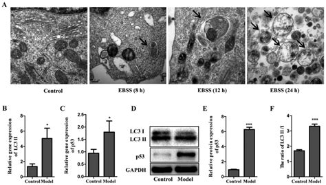 Autophagy Inhibition Enhances Radiosensitivity Of Eca‑109 Cells Via The