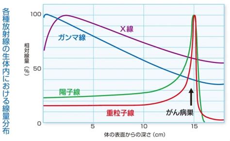 重粒子線がん治療とは｜がん拠点病院・サガハイマット｜がんポータルさが｜佐賀県のがん情報、がん検診情報