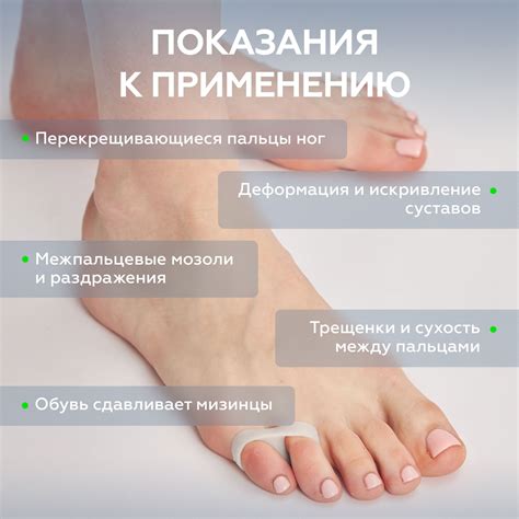 MEDKING Бурсопротектор мизинца стопы с межпальцевой перегородкой ...