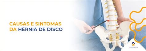 H Rnia De Disco Tipos Causas Sintomas Tratamentos Ortopedia