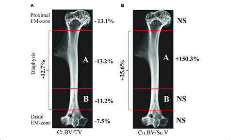 Quantitative Estimation Of Cortical And Cancellous Bone Volume