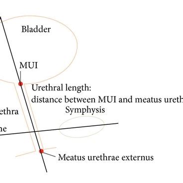 (a) Schematic illustration of bladder and measurement of urethral ...