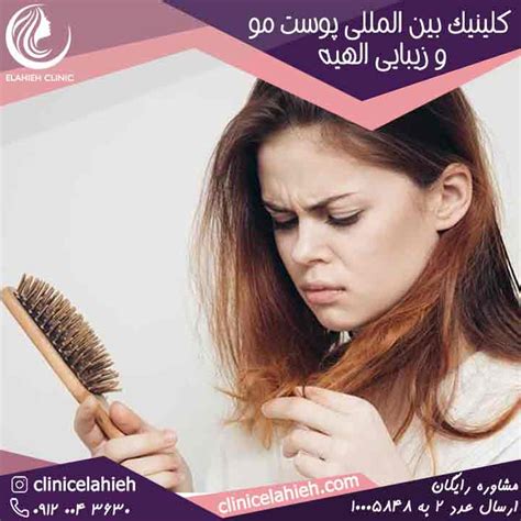 روش های جلوگیری از ریزش مو کلینیک بین المللی پوست مو و زیبایی الهیه