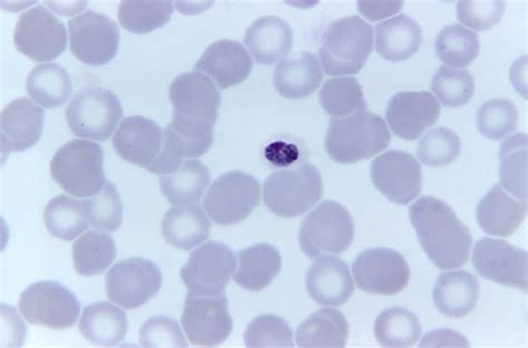 Free picture: photomicrograph, shows, mature, plasmodium malariae ... 
