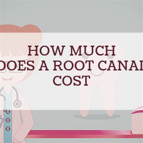 Stream Episode How Much Does A Root Canal Cost By Joseph Fulmore