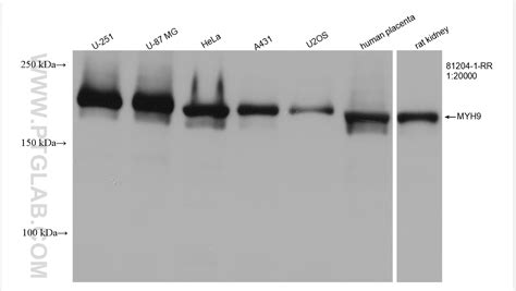 Myh9 Antibody 81204 1 Rr Proteintech 武汉三鹰生物技术有限公司