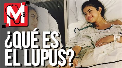 ¿quÉ Es El Lupus La Enfermedad De Selena GÓmez Youtube