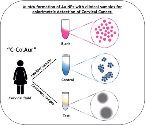 Schematic Showing The Colorimetric Detection Of Cervical Cancer Using