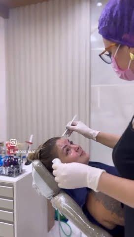 Chegou o momento tão esperando por mim fazer meu botox YouTube