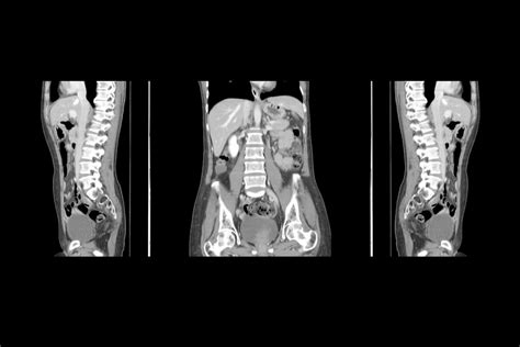 Having A Scan Heres How The Different Types Work And What They Can Find