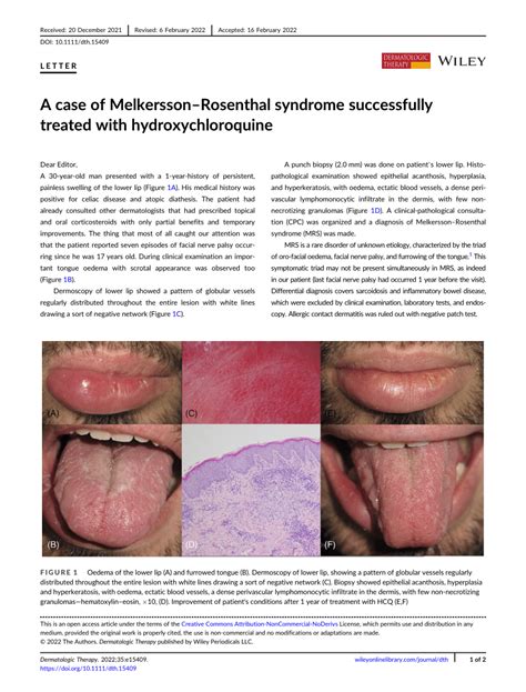 Pdf A Case Of Melkersson‐rosenthal Syndrome Successfully Treated With