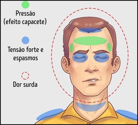 Os Tipos De Dores De Cabe A E Como Aliviar Atualizado