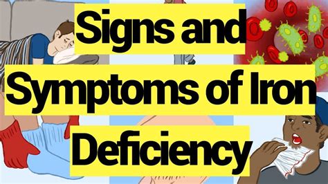 9 Signs And Symptoms Of Iron Deficiency Youtube Iron Deficiency Signs And Symptoms How To