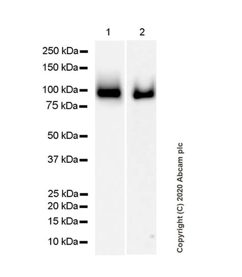 Anti Amyloid Precursor Protein 抗体 [14d6] Bsa And Azide Free Ab255770