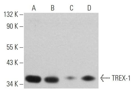 TREX 1抗体 C 11 SCBT Santa Cruz Biotechnology