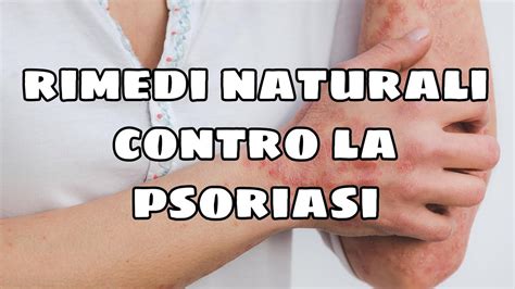 Rimedi Naturali Contro La Psoriasi Come Combattere La Psoriasi Cura