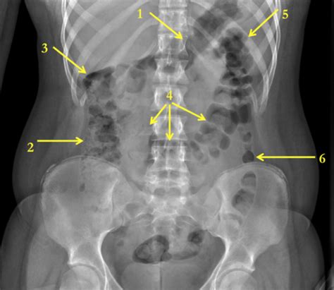 Med Imaging Gu Flashcards Quizlet