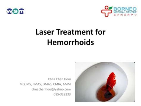 Laser Treatment For Hemorrhoids Ppt