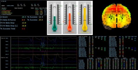 Neurofeedback How Neurofeedback Training Works Brainboost