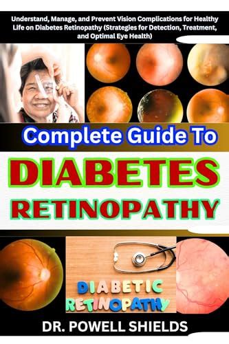 Complete Guide To Diabetes Retinopathy Understand Manage And Prevent Vision Complications For