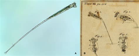 Bdelloid Rotifers By Aydin Örstan And Michael Plewka Quekett