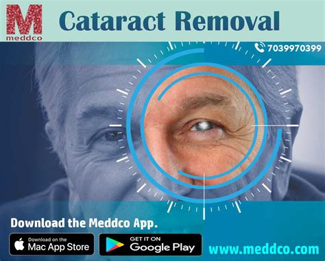 How To Prepare For Cataract Removal