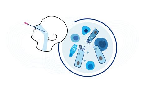 Early COVID-19 responses in the nose and throat predict disease ...